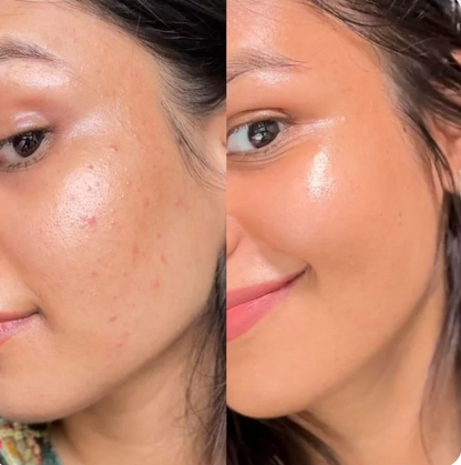 Glow Clear Kit Serum+Toallitas